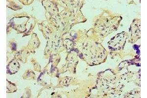 Immunohistochemistry of paraffin-embedded human placenta tissue using ABIN7156372 at dilution of 1:100 (IGFBP4 anticorps  (AA 22-258))