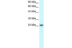 WB Suggested Anti-MXD4 Antibody Titration:  0. (MXD4 anticorps  (N-Term))