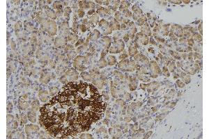 ABIN6276945 at 1/100 staining Human pancreas tissue by IHC-P. (IL1R2 anticorps  (C-Term))