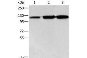 Western Blot analysis of PC3 cell, Human colon cancer and liver cancer tissue using HSP105 Polyclonal Antibody at dilution of 1:500 (HSPH1 anticorps)