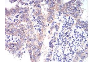 Immunohistochemistry (IHC) image for anti-Aldehyde Dehydrogenase 6 Family, Member A1 (ALDH6A1) (AA 1-195) antibody (ABIN5856297) (ALDH6A1 anticorps  (AA 1-195))