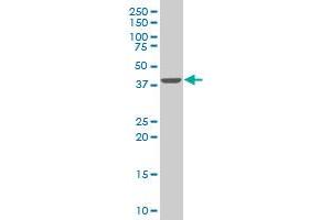 SMARCB1 monoclonal antibody (M03), clone 3C4 Western Blot analysis of SMARCB1 expression in Hela S3 NE .