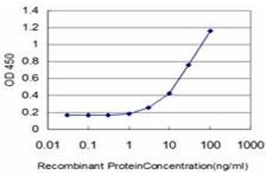 Image no. 1 for anti-Eukaryotic Translation Initiation Factor 4 gamma 3 (EIF4G3) (AA 1-516) antibody (ABIN599055) (EIF4G3 anticorps  (AA 1-516))