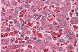 Human Liver (formalin-fixed, paraffin-embedded) stained with A2M antibody ABIN396916 at 10 ug/ml followed by biotinylated goat anti-rabbit IgG secondary antibody ABIN481713, alkaline phosphatase-streptavidin and chromogen. (alpha 2 Macroglobulin anticorps  (C-Term))