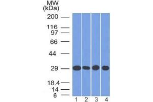 anti-Prohibitin 1 / PHB1 (AA 167-261) antibody