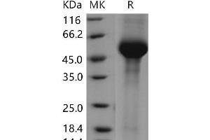 Western Blotting (WB) image for Galactosidase, alpha (GLA) (Active) protein (His tag) (ABIN7320092)