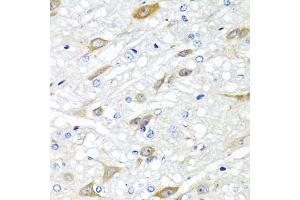 Immunohistochemistry of paraffin-embedded rat brain using CP antibody (ABIN6129673, ABIN6138930, ABIN6138932 and ABIN6217722) at dilution of 1:100 (40x lens). (CPA6 anticorps  (AA 130-437))