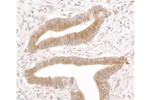 Immunohistochemistry (IHC) image for anti-Reticulocalbin 1, EF-Hand Calcium Binding Domain (RCN1) (AA 1-75) antibody (ABIN7453447) (RCN1 anticorps  (AA 1-75))