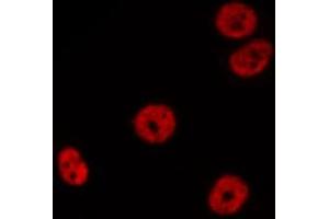 ABIN6268895 staining K-562 cells by IF/ICC.