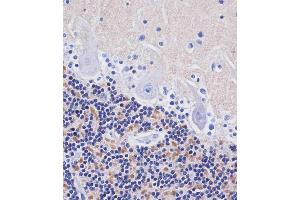 ABIN653897 staining H in human cerebellum tissue sections by Immunohistochemistry (IHC-P - paraformaldehyde-fixed, paraffin-embedded sections). (AMH anticorps  (AA 424-451))