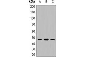 Western blot analysis of CACNG5 expression in HepG2 (A), mouse liver (B), RAW264. (CACNG5 anticorps)