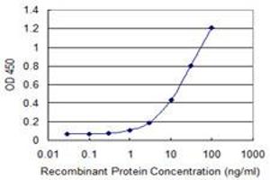 Detection limit for recombinant GST tagged USP45 is 0. (USP45 anticorps  (AA 106-196))