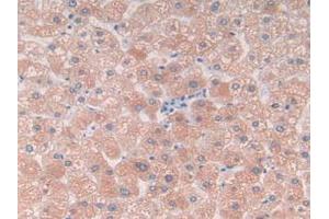 IHC-P analysis of Human Liver Tissue, with DAB staining. (C9 anticorps  (AA 22-265))