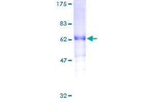 Image no. 1 for C-Fos Induced Growth Factor (Vascular Endothelial Growth Factor D) (Figf) (AA 1-354) protein (GST tag) (ABIN1354094)