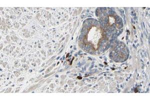 ABIN6277164 at 1/100 staining Human prostate tissue by IHC-P. (Phospholipase C gamma 2 anticorps  (Internal Region))