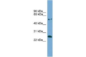 WB Suggested Anti-ETHE1  Antibody Titration: 0.