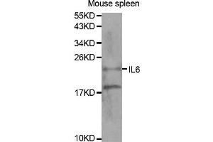 Western blot analysis of extracts of mouse spleen tissue, using IL6 antibody. (IL-6 anticorps)
