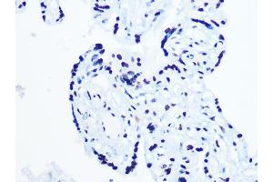 Immunohistochemistry of paraffin-embedded human placenta using DHX9/DHX9/RNA Helicase A Rabbit mAb (ABIN7265747) at dilution of 1:100 (40x lens).