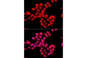 Immunofluorescence analysis of A549 cell using CAMK1D antibody. (CAMK1D anticorps)