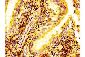 IHC image of ABIN7152068 diluted at 1:500 and staining in paraffin-embedded human lung tissue performed on a Leica BondTM system.