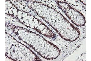Image no. 3 for anti-Malignant T Cell Amplified Sequence 1 (MCTS1) (AA 1-181) antibody (ABIN1490598)