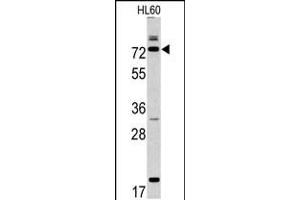 Western blot analysis of CAPN9 antibody in HL60 cell line lysates (35ug/lane) (Calpain 9 anticorps  (N-Term))