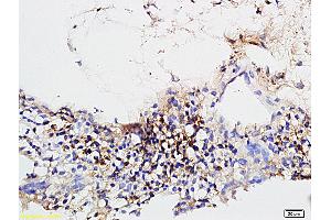 Formalin-fixed and paraffin embedded rabbit sclera tissue labeled with Rabbit Anti-CD31/PECAM-1 Polyclonal Antibody (ABIN726140) at 1:600 followed by conjugation to the secondary antibody and DAB staining. (CD31 anticorps  (AA 681-738))