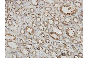 Immunoperoxidase of monoclonal antibody to MAPKAPK2 on formalin-fixed paraffin-embedded human kidney.