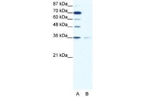 ZNF326 antibody (20R-1071) used at 0. (ZNF326 anticorps  (C-Term))