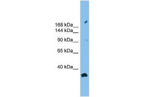 WB Suggested Anti-PACS2 Antibody Titration: 0. (PACS2 anticorps  (Middle Region))