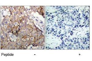 Image no. 1 for anti-Epidermal Growth Factor Receptor (EGFR) (Tyr1092) antibody (ABIN197230) (EGFR anticorps  (Tyr1092))