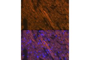 Immunofluorescence analysis of mouse heart cells using Cardiac troponin T (TNNT2) Rabbit pAb (ABIN3021485, ABIN3021486, ABIN3021487 and ABIN6215132) at dilution of 1:100 (40x lens). (Cardiac Troponin T2 anticorps  (AA 1-120))