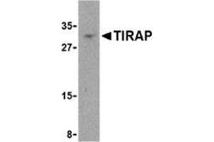 Western blot analysis of TIRAP in MCF-7 cell lysate with this product at 4 μg/ml. (TIRAP anticorps  (Center))