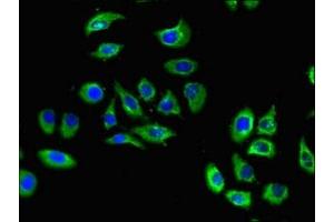 Immunofluorescent analysis of A549 cells using ABIN7170577 at dilution of 1:100 and Alexa Fluor 488-congugated AffiniPure Goat Anti-Rabbit IgG(H+L) (S1PR5 anticorps  (AA 309-398))