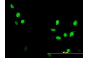 Immunofluorescence of monoclonal antibody to CDC2 on HeLa cell.