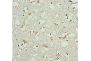 Immunohistochemistry of paraffin-embedded human brain tissue using ABIN7151540 at dilution of 1:100 (EEF1B2 anticorps  (AA 1-225))