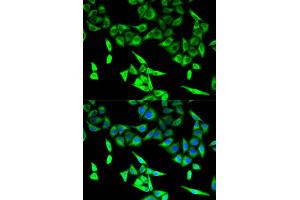 Immunofluorescence analysis of U2OS cells using HADHA antibody. (HADHA anticorps)