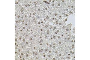 Immunohistochemistry of paraffin-embedded mouse liver using ZNF408 antibody. (ZNF408 anticorps  (AA 471-720))