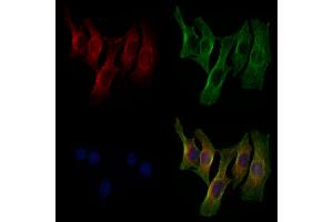 ABIN6260176 and ABIN6279187 staining 3 by IF/ICC.