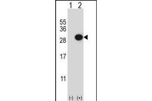 Western blot analysis of CTHRC1 (arrow) using rabbit polyclonal CTHRC1 Antibody (N-term) (ABIN652724 and ABIN2842480). (CTHRC1 anticorps  (N-Term))