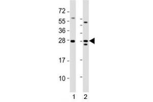 Western blot testing of Lin28a antibody at 1:2000 dilution.