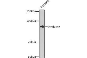 Western blot analysis of extracts of Rat lung cells, using Involucrin antibody (ABIN6128025, ABIN6141815, ABIN6141818 and ABIN7101419) at 1:500 dilution.