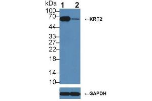 Western blot analysis of (1) Wild-type A431 cell lysate, and (2) KRT2 knockout A431 cell lysate, using Rabbit Anti-Rat KRT2 Antibody (1 µg/ml) and HRP-conjugated Goat Anti-Mouse antibody (