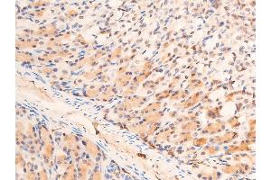 ABIN6267073 at 1/100 staining mouse gastric tissue sections by IHC-P. (CHEK1 anticorps  (pSer280))