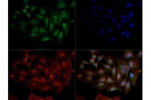 Immunofluorescent staining of HeLa cells with DNMT1 monoclonal antibody, clone 60B1220. (DNMT1 anticorps  (AA 637-650))