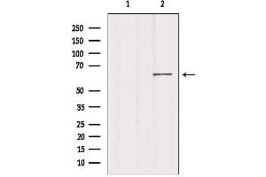 Western blot analysis of extracts from 293, using MED26 Antibody. (MED26 anticorps  (N-Term))