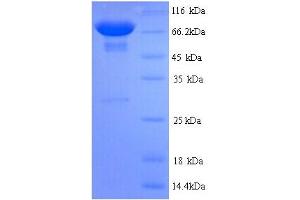 SDS-PAGE (SDS) image for Pyruvate Kinase, Liver and RBC (PKLR) (AA 1-574), (full length) protein (His tag) (ABIN5713734) (PKLR Protein (AA 1-574, full length) (His tag))
