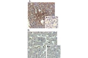 Immunohistochemical staining of human tissue using anti-ANGPTL4 (human), mAb (Kairos-1)  at 1:500 dilution.
