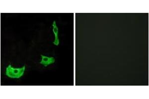 Immunofluorescence analysis of HeLa cells, using GPR17 Antibody. (GPR17 anticorps  (AA 196-245))