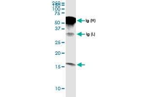 Immunoprecipitation of G0S2 transfected lysate using anti-G0S2 MaxPab rabbit polyclonal antibody and Protein A Magnetic Bead , and immunoblotted with G0S2 MaxPab rabbit polyclonal antibody (D01) . (G0S2 anticorps  (AA 1-103))